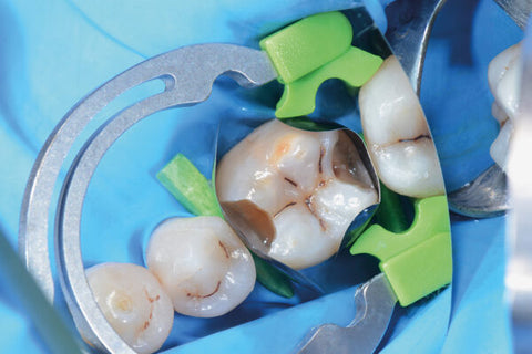 myTines GO 6307 (6 pairs) - Blue & Green Inc.