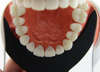 Upper Silicone Contrastor (190777 & 190778) Contrastor - Blue & Green Inc.
