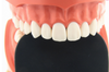 Double Ended Palatal Contrastor (190783) Contrastor - Blue & Green Inc.