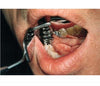 Tongue Protector w/ Mirror (190515) Retractors - Blue & Green Inc.